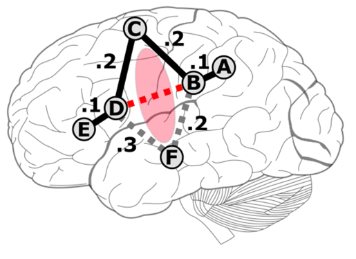 Brain with edges